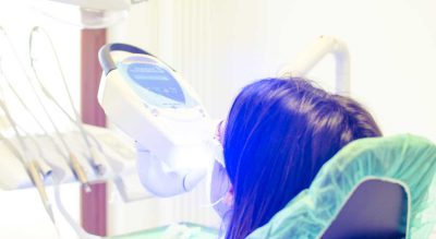 Sbiancamento denti paziente, Clinica Dentale Gazzieri