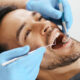 Quanto dura la pulizia dei denti