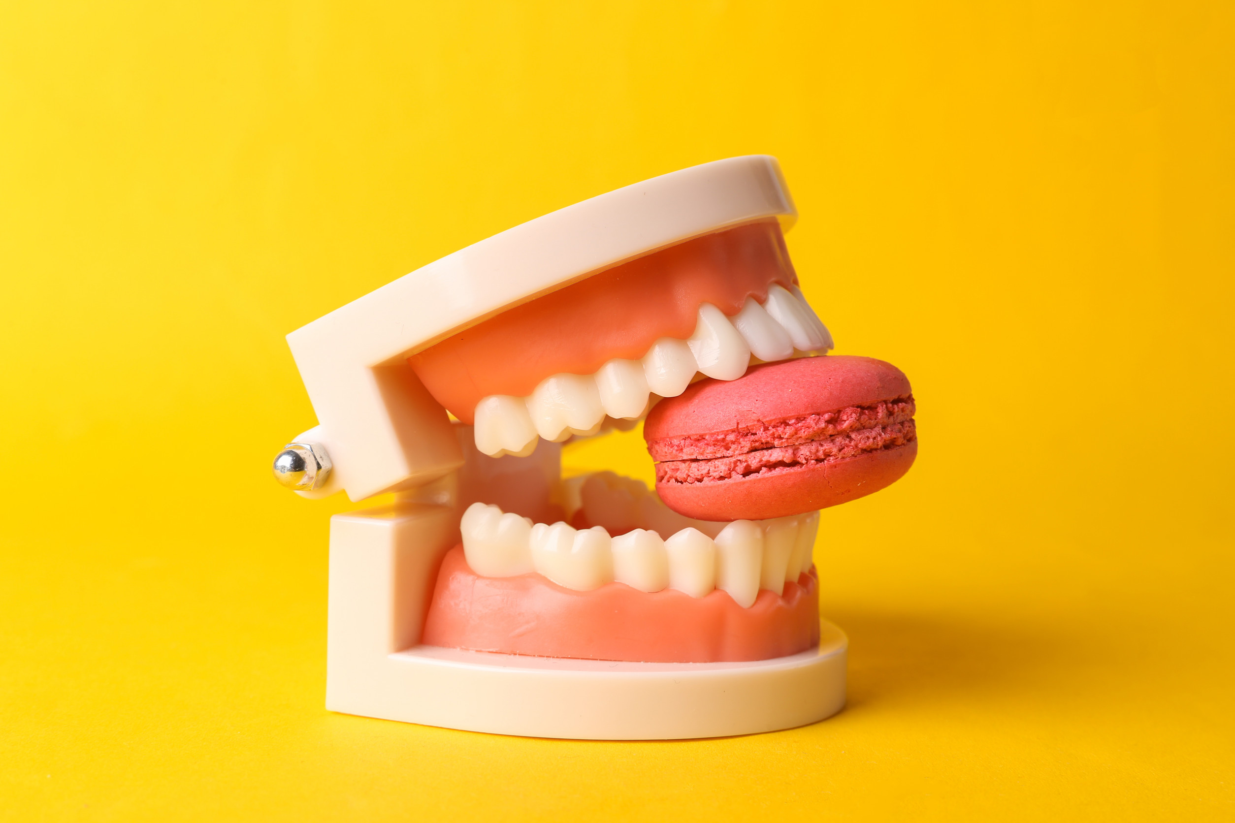 Cosa fare dopo un impianto dentale