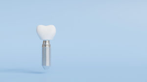 Impianti dentali senza osso