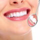 Come mettere le faccette dentali