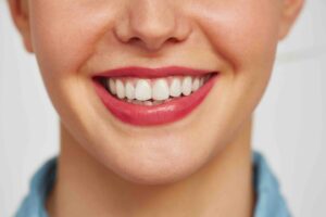 Faccette dentali