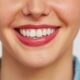 Faccette dentali