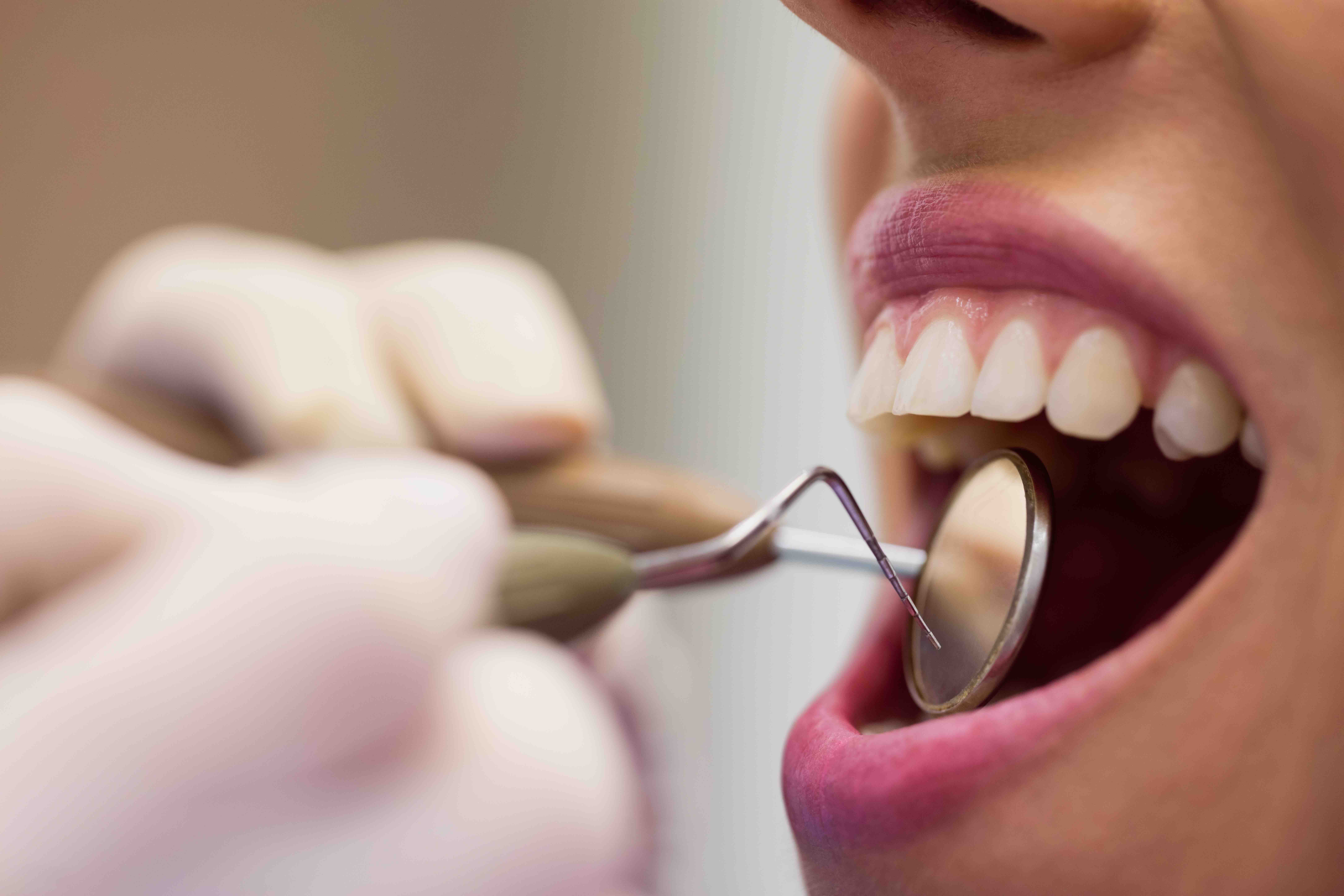 quando prenotare la prima visita dentistica