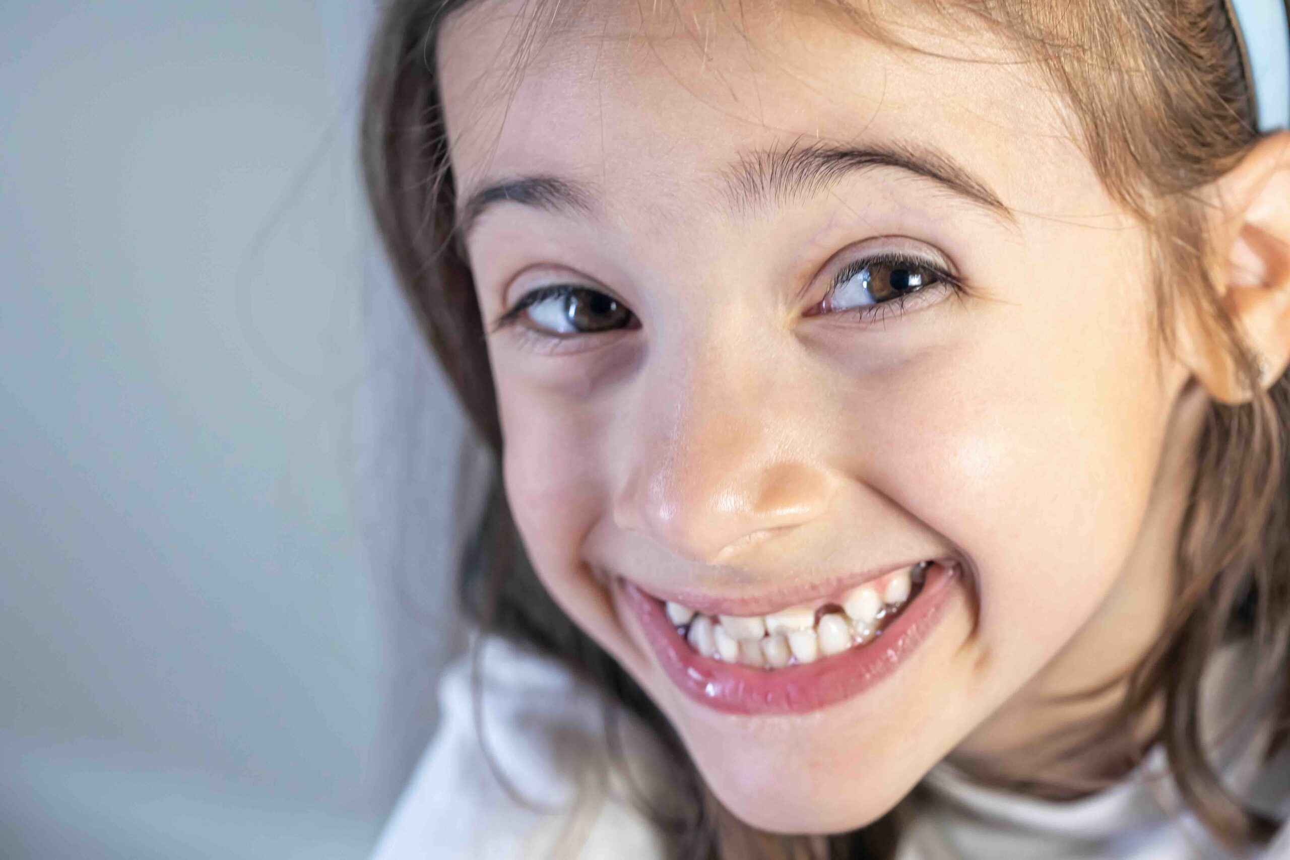 Quando spuntano i canini nei bambini