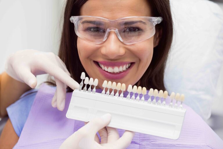 Pulire faccette dentali