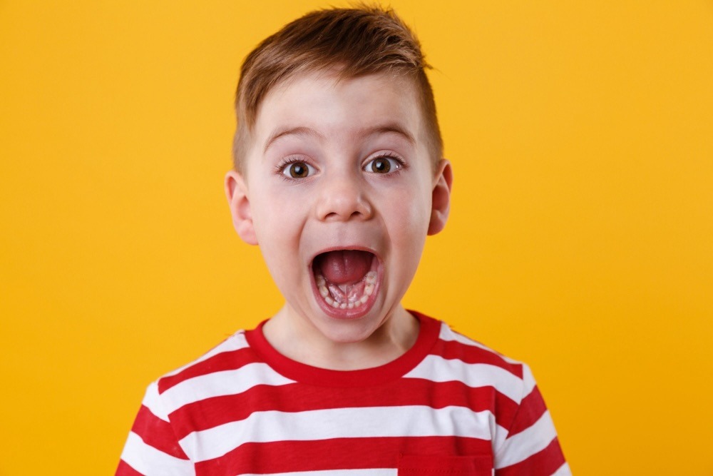 segnali del palato stretto nei bambini
